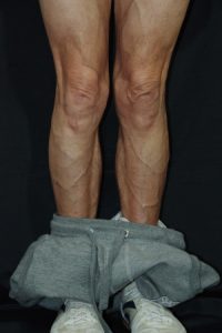 Die Hose herunterlassen